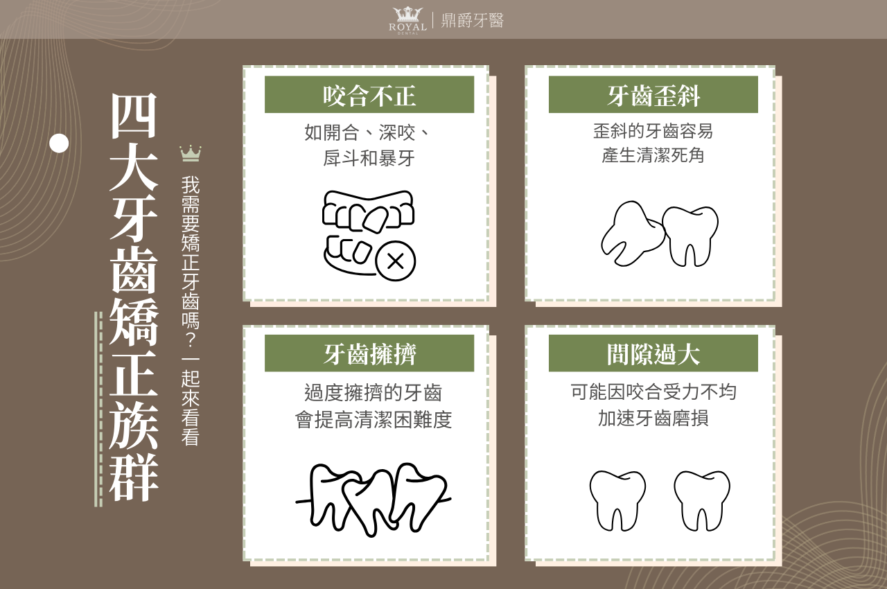 4大牙齒矯正族群